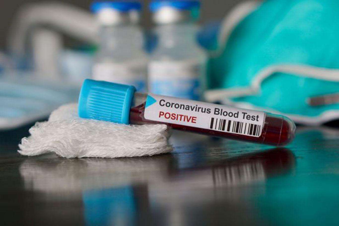 Coronavirus bilançosu açıklandı!