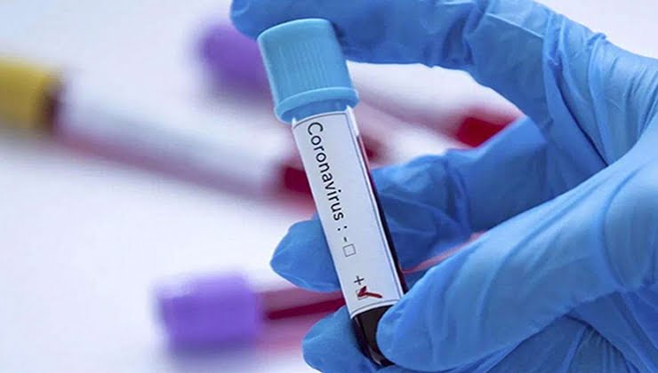 Türkiye'de Coronavirus'ten vefat sayısı 99 bini geçti