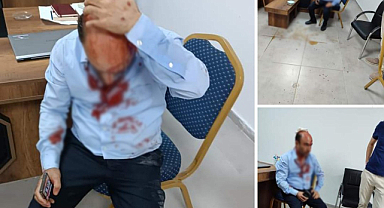 Şanlıurfa'da okul müdürü saldırıya uğradığı iddiası
