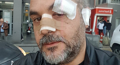Burger King'i protesto etti diye saldırıya uğradı!