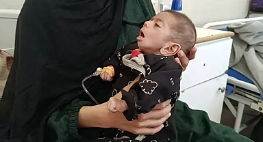 Gazze'de bir bebek daha açlıktan dolayı şehid oldu