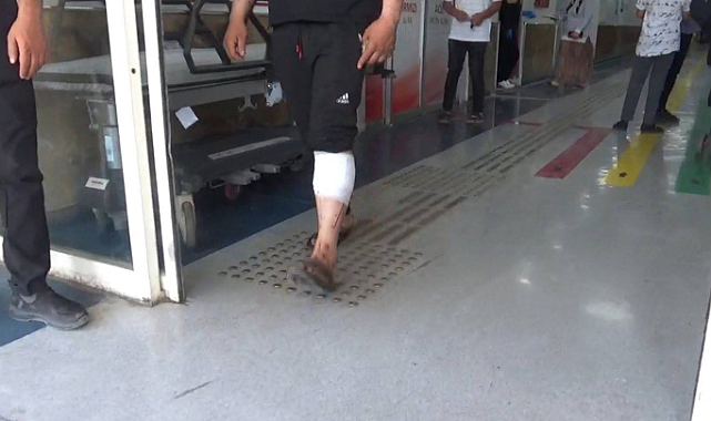 Şanlıurfa'da 176 acemi kasap hastanelik oldu