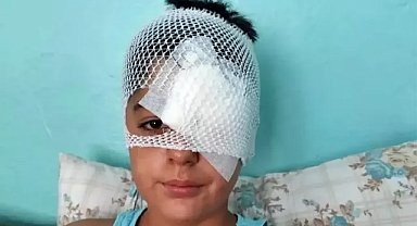 Köpekten kaçan çocuğa otomobil çarptı