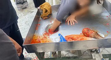 Şanlıurfa’da salça makinesine eli sıkışan genç kız kurtarıldı