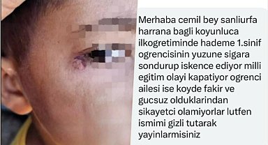 Yüzüne sigara söndürülen öğrenci davasında yeni gelişme